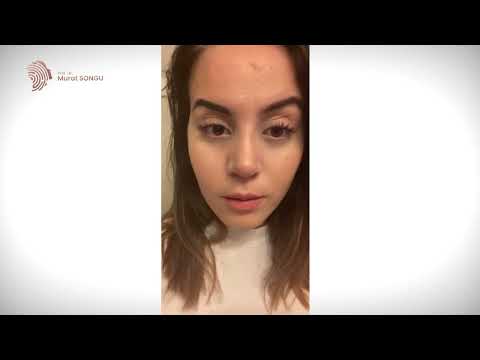 YouTube-Video-Thumbnail