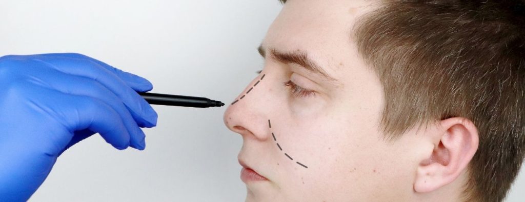 Piezo Burun Estetiği Fiyatları