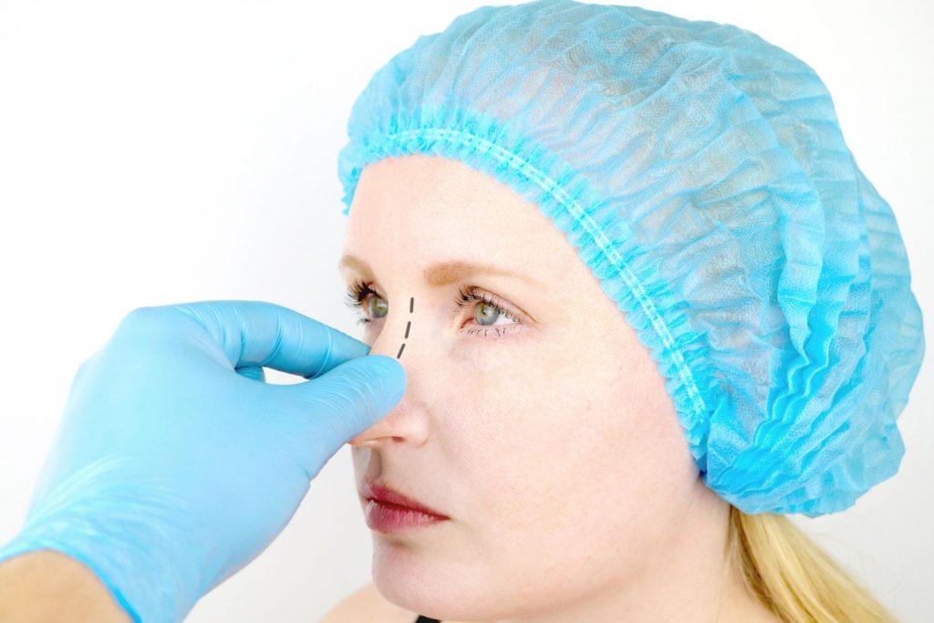 Discovering Ultrasonic Rhinoplasty Abroad 
