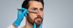 What Is Closed Rhinoplasty?