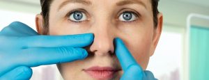 Am I A Candidate for A Nose Job?