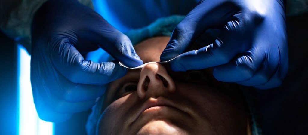 Burun Ameliyatından Sonra Septumda Delinme Olur Mu?