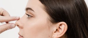 Asymmetrie der Nasenlöcher nach einer Nasenkorrektur