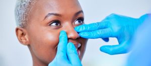 What to Expect During Revision Rhinoplasty Recovery?