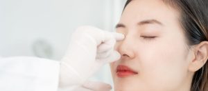 Injerto costal para reconstrucción nasal
