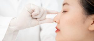 Should I Use The Same Surgeon For My Revision Rhinoplasty?
