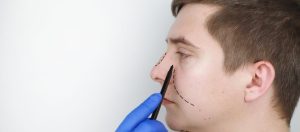 Nasenoperation bei fettiger und trockener Haut