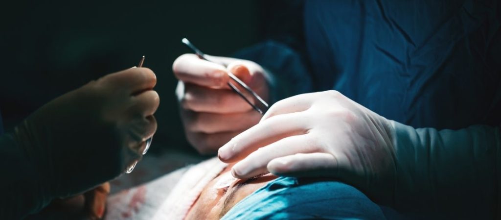 18 Yaş Altı Burun Estetiği Olur Mu?