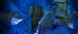 Nose Rasping Surgery in Turkey