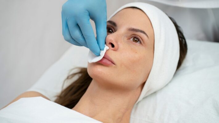 When Is a Second Rhinoplasty (Revision) Necessary?